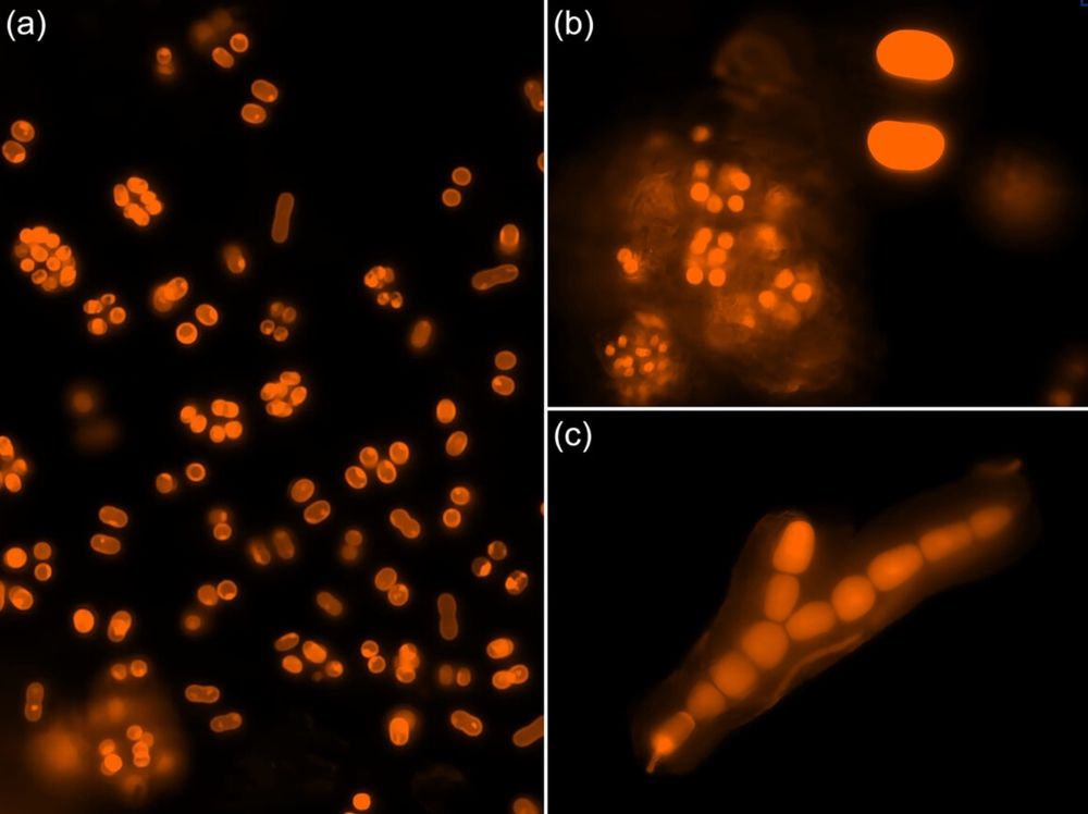 The study contributes to the seasonal exploration of phototrophic biofilms and ecological parameters at the entrance zone of Petnica Cave. It focuses on the phototrophic biofilm component, with particular attention to the changes in the community over the seasons, the influence of ecological parameters on phototrophic microbial groups, and the appearance and structure of biofilms. The results emphasize the importance of moisture for the composition and resilience of the biofilm and provide insights into the seasonal adaptations of microorganisms in the cave entrance zone ecosystem.