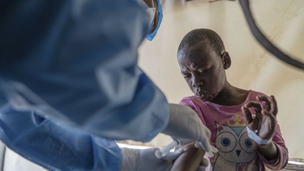 Mpox deaths rise by 107 in a week as Africa CDC calls the toll unacceptable