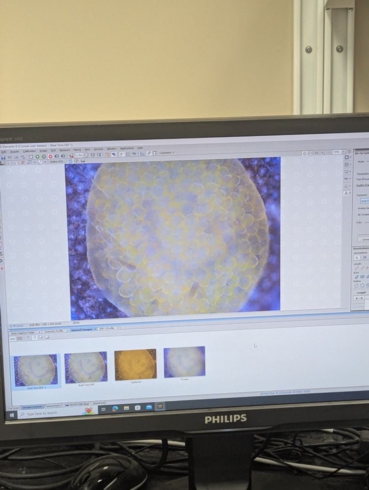 This is a highly magnified image of a cranberry fireworm egg. The image is focus-stacked, a technique where multiple macro photos with thin focal planes are taken along a z-axis, then the focal planes are stitched together to make a single high resolution image. The egg is full of yellow fat globs and some vague shapes that look a little like a smiley face.