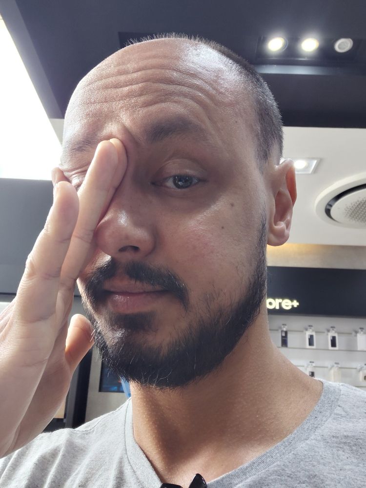 selfie com dedos da mão direita em cima do olho direito.