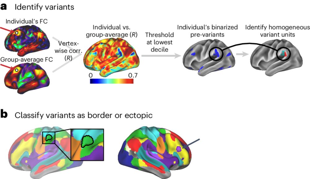 Two common and distinct forms of variation in human functional brain networks