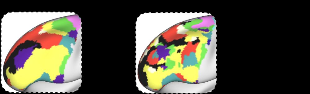 Image of brain networks in a group average and individual LPFC. Individuals show:
1) smaller FP network
2) more interdigitation
3) conserved motifs
4) idiosyncratic features
This was validated with task and rest fMRI