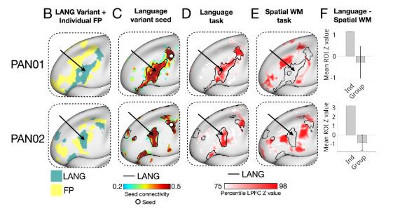 Unusual pieces of the language network (defined with resting-state fMRI) show activity in a language task, but not a spatial WM task.