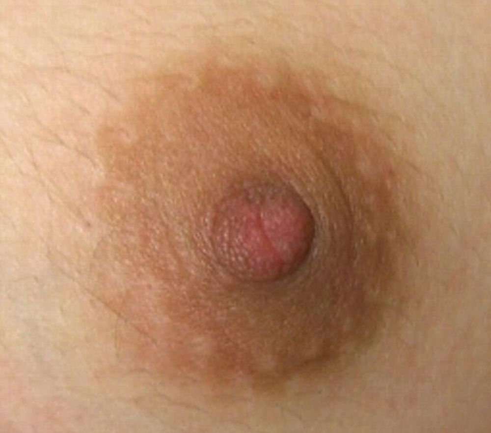 Areola - Wikipedia