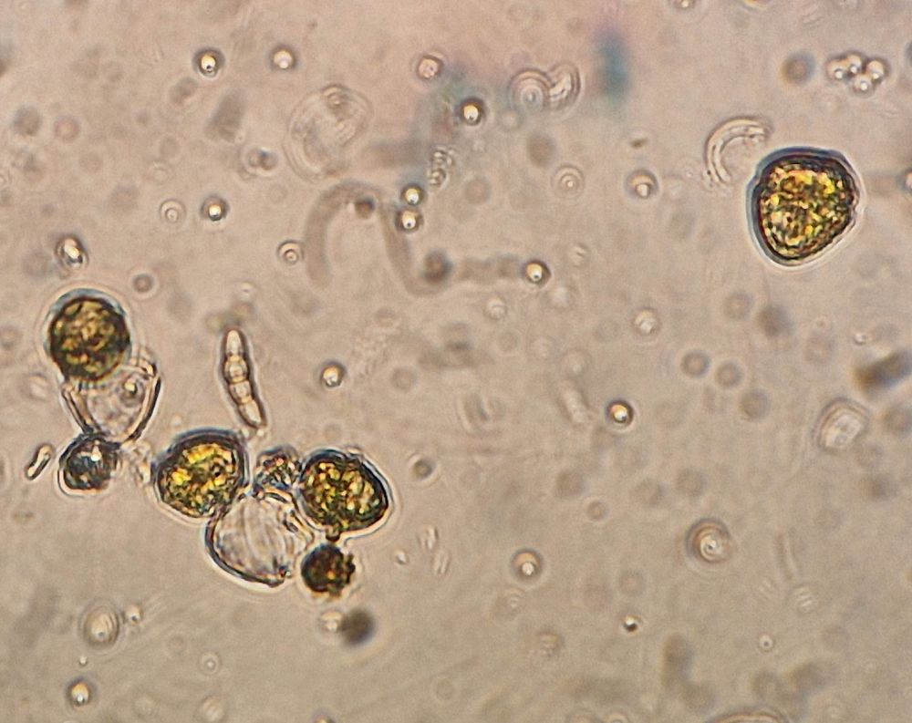 Dinoflagellates and other protists