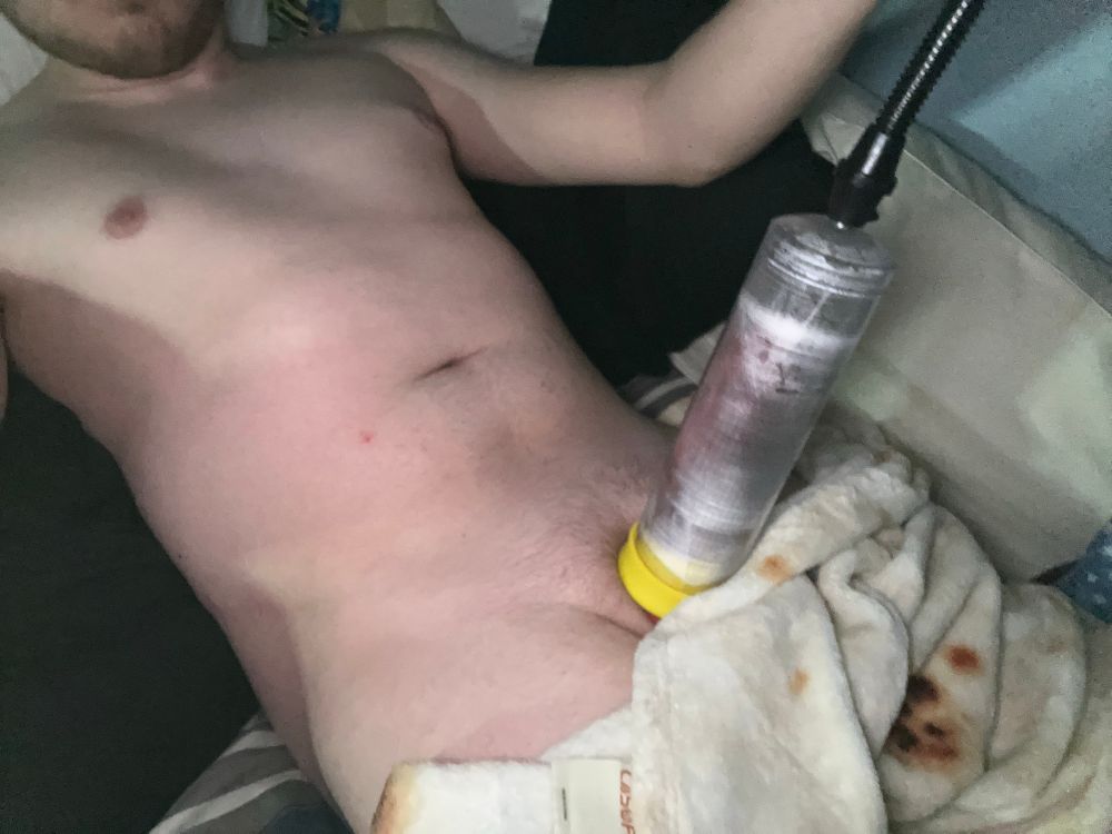 Laying in bed nude blankets covering thighs down while cock is inside cock pump getting big and red and swollen 
