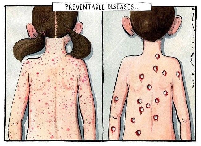 cartoon-style illustrated Image titled "Preventable Diseases". 2 panel illustration

Left panel: depiction of a child's back who has Measles

Right panel: Depiction of a child's back riddled with bullet holes