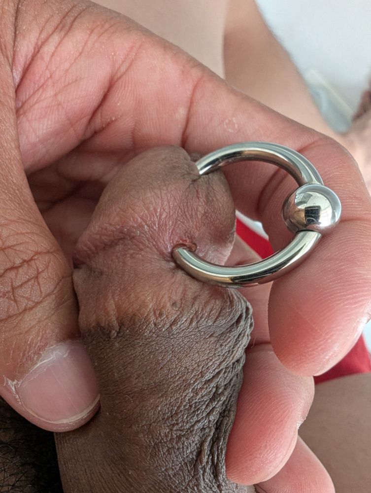 My PA piercing, showing the PA ring hole and how it's healing from an outside view.