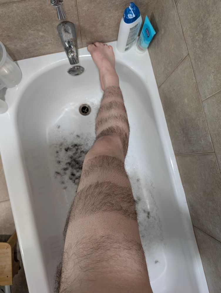 A picture of one of my leg, shaved in a way that has a pattern alternating between a shaved band and an unshaved band