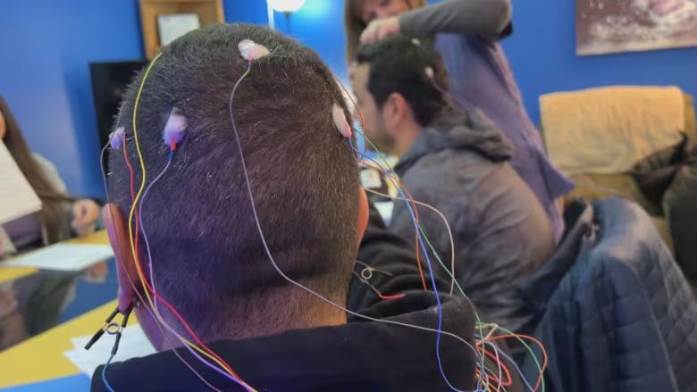 Electrodes are taped to a patient's head and wires trail down their shoulders. Another patient is having electrodes applied in the background.