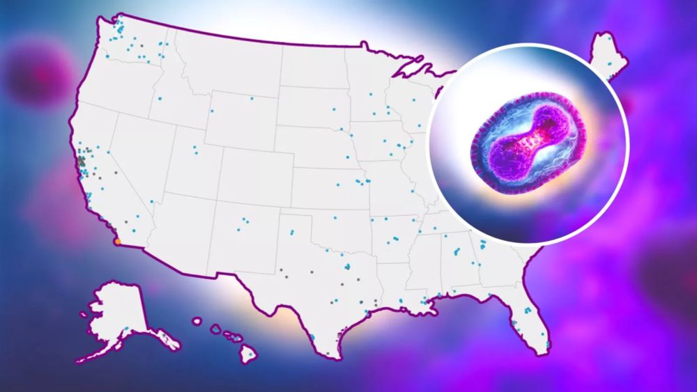 Mpox map shows US states with virus in wastewater as outbreak hits Africa