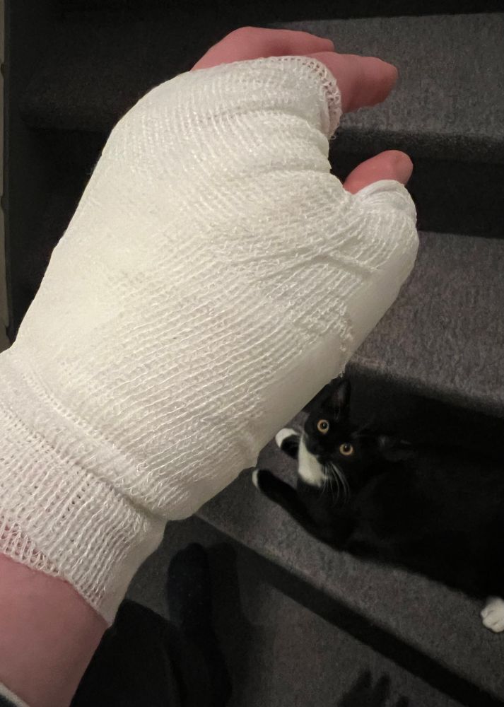Bandaged hand with cat in background.