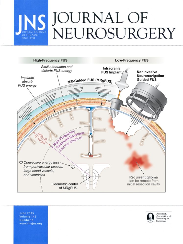 The June 2025 cover of the Journal of Neurosurgery. The cover illustration depicts the clinical applications of high-frequency and low-frequency focused ultrasound (FUS) in the management of glioma. Art by Ken Probst.