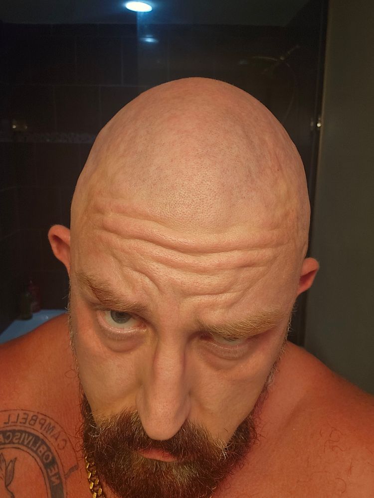 A bald man, me, sjot slightly from above, so you can see most of the top of his head. He is bearded, wearing a copper chain.
He has a wrinkly forehead.