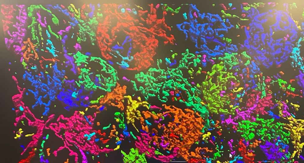 Reconstruction of mitochondria from
Confocal imaging of human cells 