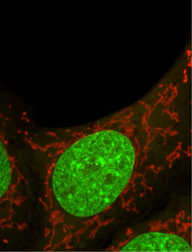 Mitotracker staining (orange) and nucleus (green)  in Hela cells 