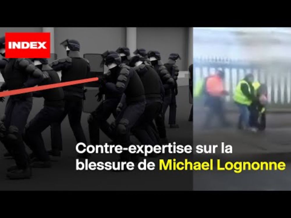 Contre-expertise sur la blessure de Michael Lognonne