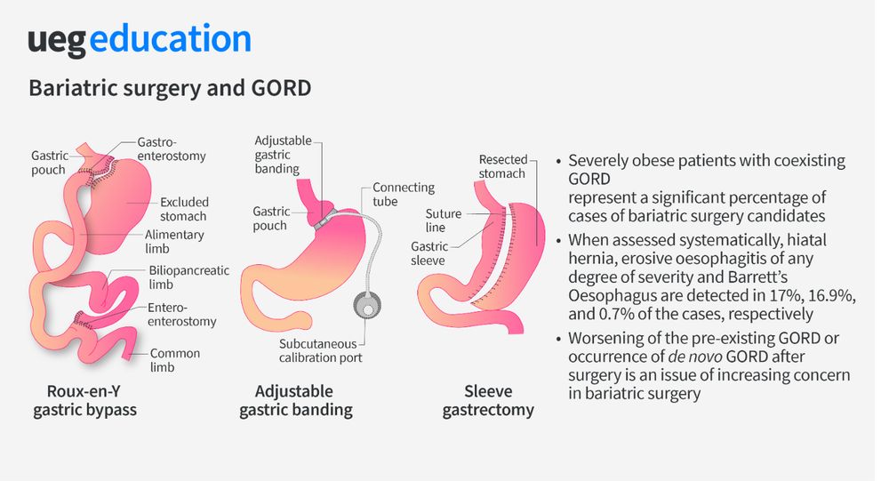a diagram of the internal organs