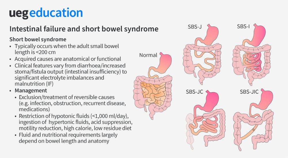 a diagram of the internal organs of the intestine