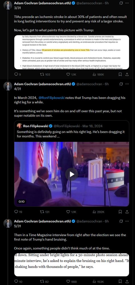 Adam Cochran (adamscochran.eth) @adamscochran: 3/31 TIAs precede an ischemic stroke in about 30% of patients and often result in long lasting interventions to try and prevent any risk of a larger stroke. Now, let's get to what paints this picture with Trump: [Image of text. Highlighted bullet point: History of TIAs: About 30 percent of strokes are preceded by one or more TIAs that can occur days, weeks or even months before a stroke.] Adam Cochran (adamscochran.eth) @adamscochran: 4/31 In March 2024, @RonFilipkowski notes that Trump has been dragging his right leg for a while. It's something we've seen him do on and off over this past year, but not super notable on its own. Quote Ron Filipkowski @RonFilipkowski, Mar 18, 2024: Something is definitely going on with his right leg. He’s been dragging it for months. This weekend … [Embedded video.] Adam Cochran (adamscochran.eth) @adamscochran: 5/31 Then in a Time Magazine interview from right after the election we see the first note of Trump's hand bruising. Once again, something people didn't think much of at the time. [Image of text blaming this on shaking hands.] 