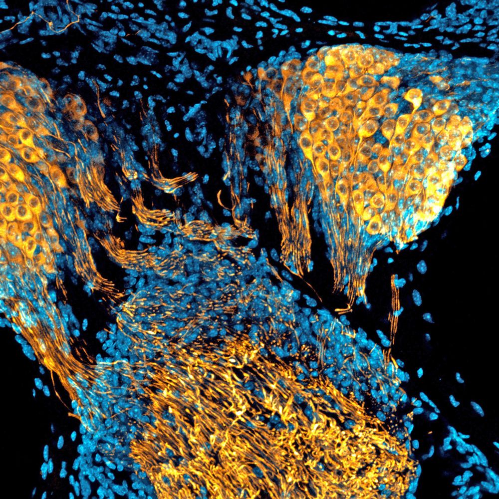 Two ganglions are packed with nerve cell bodies, each nerve cell sends neurites (axons, wires; stained in a gold colour) into a larger cable of fibres that takes auditory messages to the brain. There are many interspersed non-neuronal cells (glia, bone) whose nuclei are stained blue.