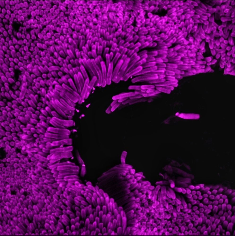An image of frog rod photoreceptor outer segments. They look round and soft, like a shag carpet. 