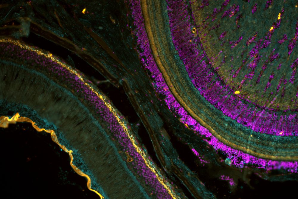 The simple retina and optic lobe of a bobtail squid eye and brain. Orange = wheat germ agglutinin, magenta = Hoechst nuclear stain, cyan = tubulin