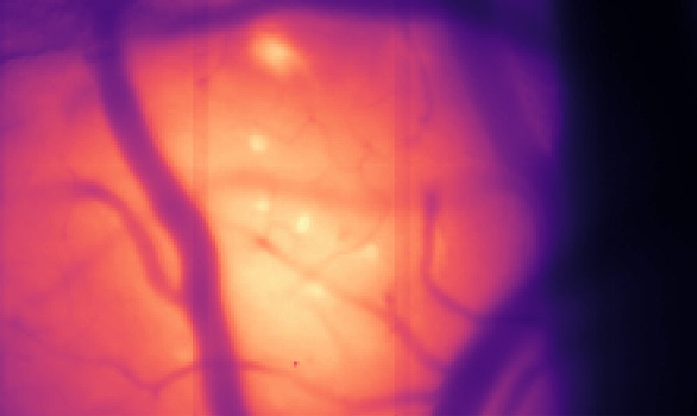 Brightly labelled pyramidal cells in the mouse retrosplenial cortex. Blood vessels are visible of various thicknesses in darker colours. 