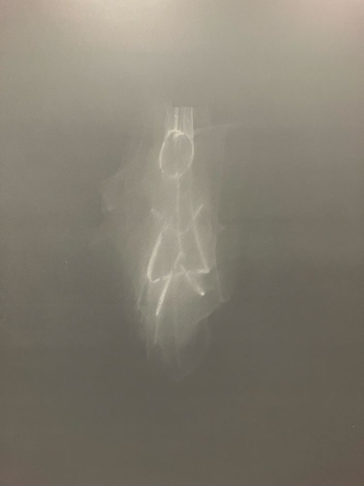 A poorly-erased chalk drawing of a stick figure wearing a skirt that resembles the possibly-cursed mysterious symbol from the TV show Yellowjackets 