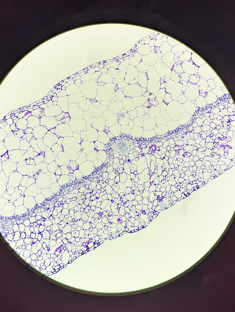 Photo of a cross section through a peperomia leaf stained blue with Toluidine blue. A large layer of succulent epidermis is on top, followed by a narrow band of palisade mesophyll and lots of large spongy mesophyll cells.