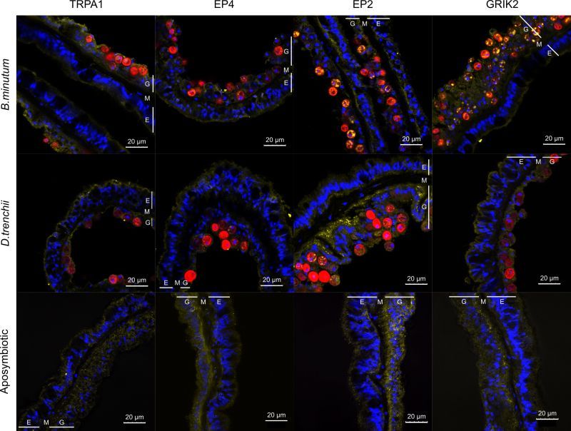 Immunocytochemistry fluorescent microscopy image showing the localisation of different oxylipin receptors in the anemone Exaiptasia diaphana.