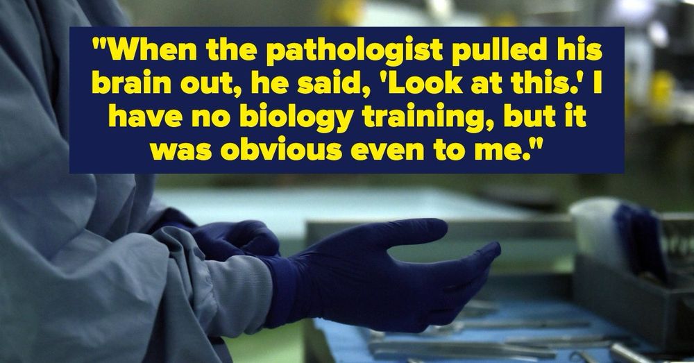 "When I opened his skull, there was no brain. There was approximately 1.5 liters of fluid and just an empty skull."