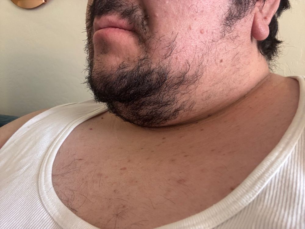 Close up view of my scruffy doublechin swallowing up my neck. My slightly hairy chest is visible under my tank top