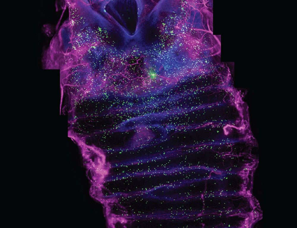 (Don’t) take my breath away: Rare epithelial cells in our airways initiate reflexes to guard against harmful stimuli