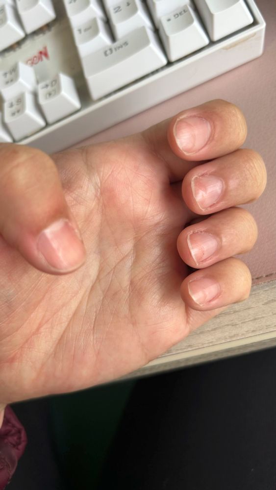 unhas da mão no formato de garra, como se fosse segurar alguma coisa. dá pra ver que uma parte da unha está com uma cor mais brilhante e o resto mais opaco. a parte brilhante foi lixada até uma camada inferior da unha, e ficou marcado no formato da cuticula.