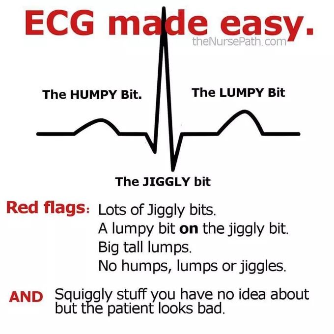 Abgebildet ist ein vereinfachter "QRST-Komplex"

Beschriftet: The HUMPY bit / the JIGGLY bit / the LUMPY bit

Red flags:
Lots of Jiggly bits
A lumpy bit ON the jiggly bit
Big tall lumps
No humps,lups or jiggles.

AND: Squiggly stuff you have no idea about but the patient looks bad.