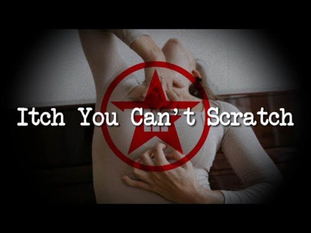 "Itch You Can't Scratch" | Creepypasta