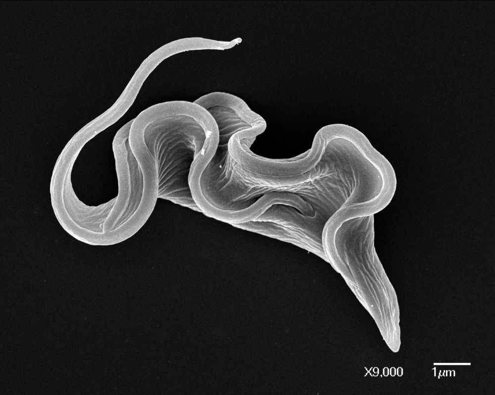 Forme sanguine de Trypanosoma brucei, parasite flagellé responsable de la maladie du sommeil en l'Afrique Centrale. Microscopie électronique à balayage. 

Crédit :
Institut Pasteur/Thierry Blisnick, unité Biologie cellulaire des Trypanosomes. Acquisition à la Plate-Forme de Microscopie Ultrastructurale