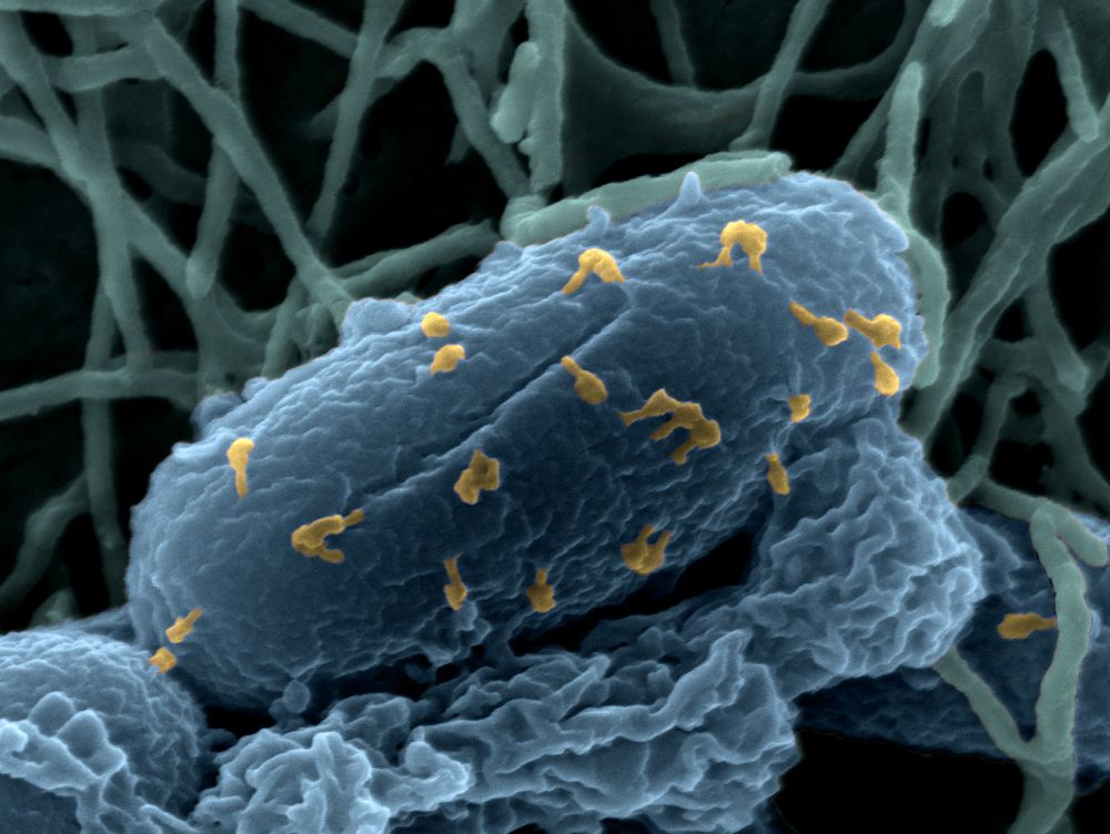 Bacteriophages infecting an Escherichia coli bacterium.
Credit: Institut Pasteur/Chantal Le Bouguénec (Pathogenic Gram-Positive Bacteria Biology Unit) and Laurent Debarbieux (Molecular Biology of the Gene in Extremophiles Unit). Imaging by Perrine Bomme, Ultrastructural Microscopy Platform. Colorization by Jean-Marc Panaud.







