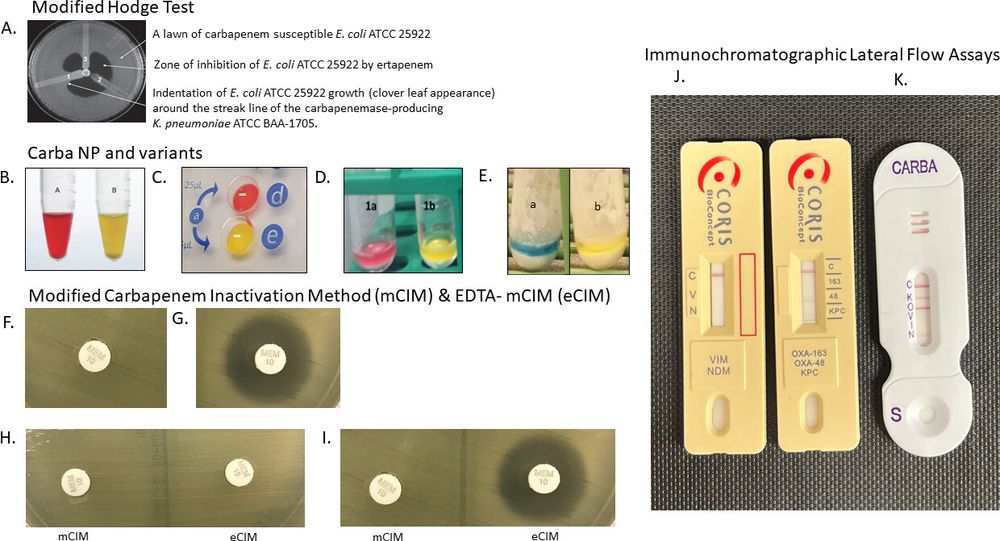 Phenotypic and immunochromatographic assays for the detection of carbapenemase-producing carbapenem-resistant organisms. 