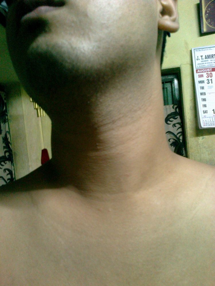 Date taken: 10.09.2015, 00:01AM
Device: Nokia 500
Place: West Bengal, India