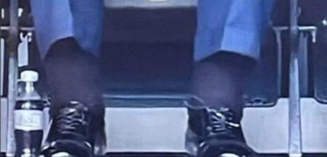 Recent close-up shot of tRumps ankles. Extremely swollen.