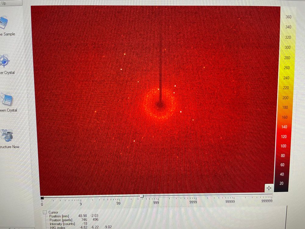 X-ray diffraction image