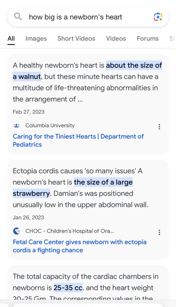 A search for “how big is a newborn’s heart” returning results that the capacity is between 25-35 ml.