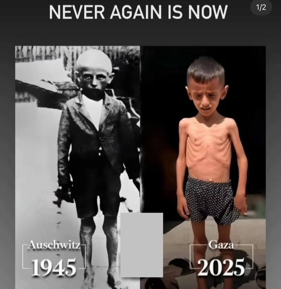 Never again is now.
A la izquierda un niño judío a punto de morir de hambre.  Auschwitz 1945
A la derecha un niño palestino punto de morir de hambre. Gaza 2025