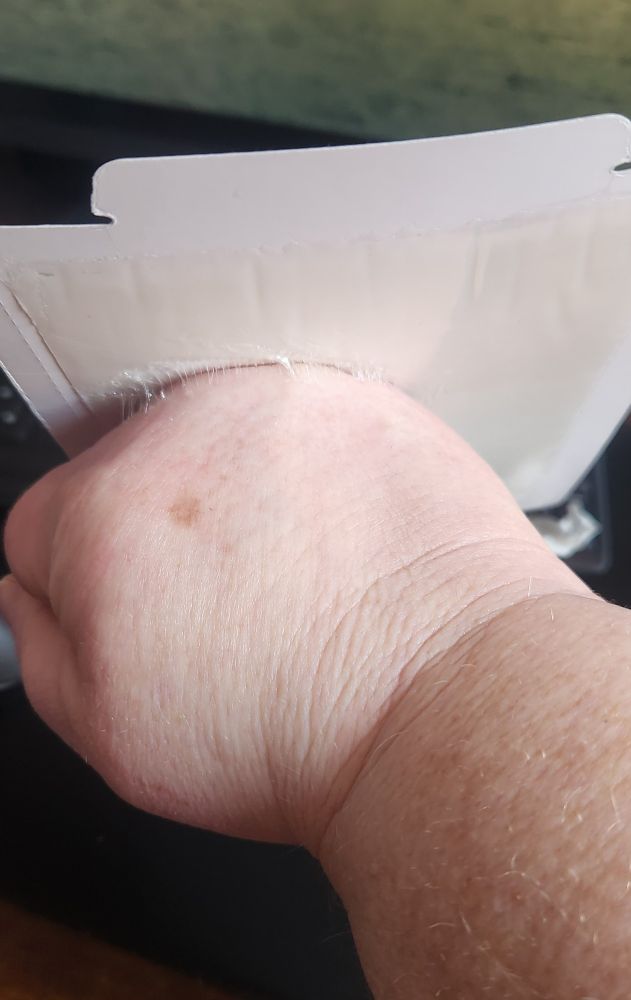 Another view of the glueboard stuck to my right hand. A fun time was not had by all.