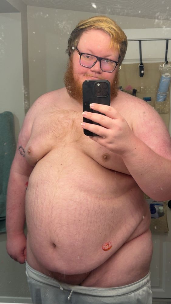 A photo of myself, belly out and shorts down, with a small pink donut bandaid on my lower stomach 