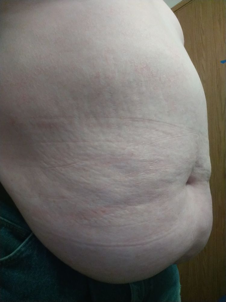 Side view of my big fat belly sagging over my jeans
