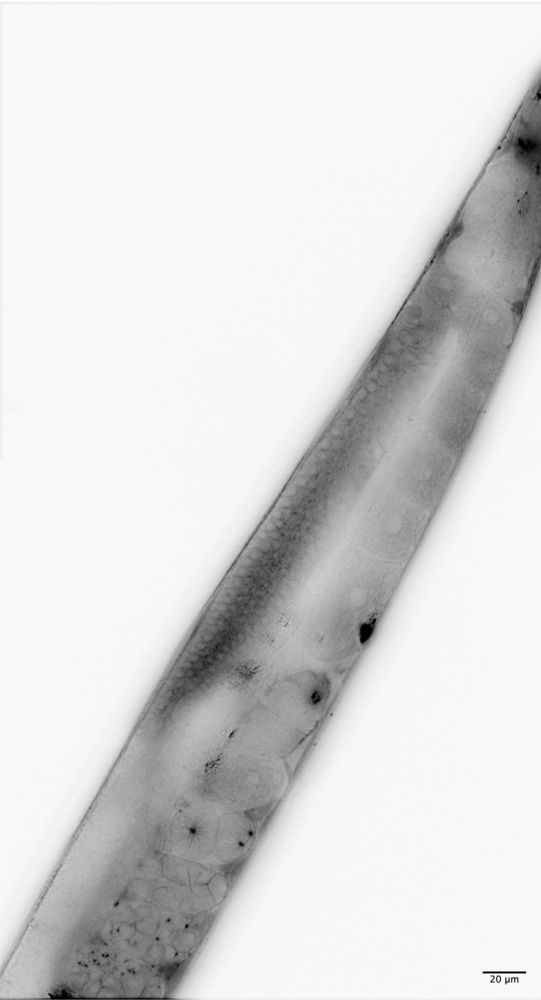 Deconvolved image of a C elegans germline expressing RFP-tubulin