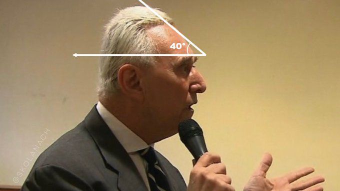 Side view of Roger Stone’s pointed head. 